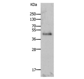 LAYN Antibody from Signalway Antibody (36948) - Antibodies.com
