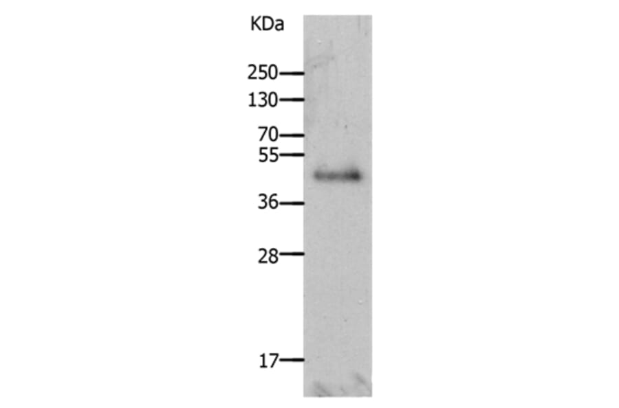 LAYN Antibody from Signalway Antibody (36948) - Antibodies.com