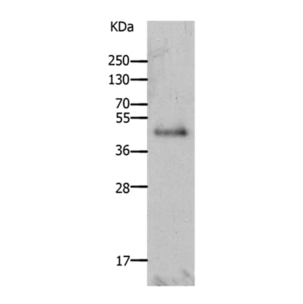 LAYN Antibody from Signalway Antibody (36948) - Antibodies.com