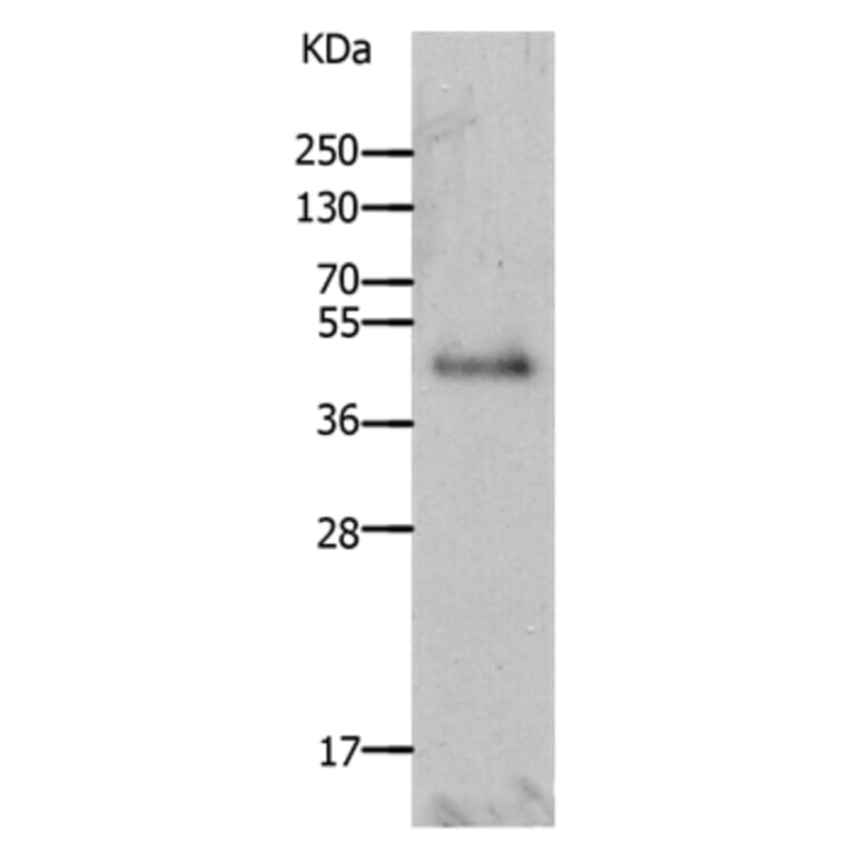 LAYN Antibody from Signalway Antibody (36948) - Antibodies.com