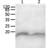 CCL8 Antibody from Signalway Antibody (36968) - Antibodies.com