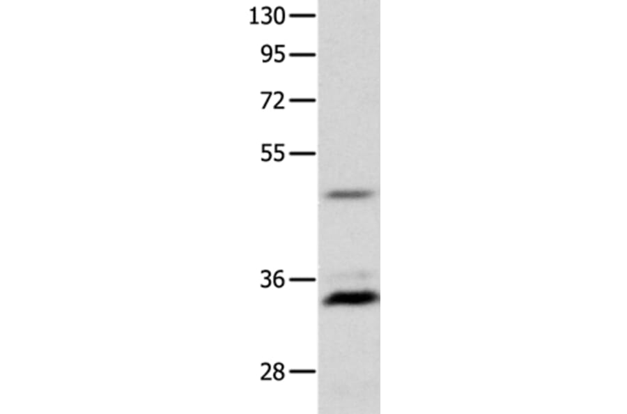 MC1R Antibody from Signalway Antibody (36969) - Antibodies.com