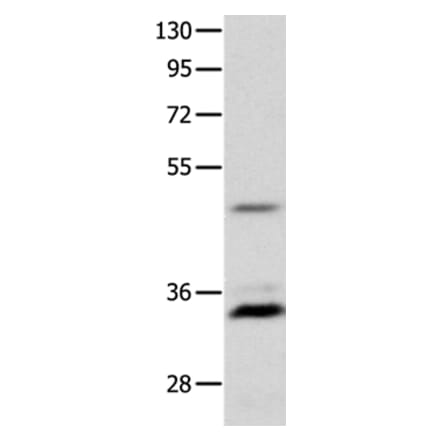 MC1R Antibody from Signalway Antibody (36969) - Antibodies.com