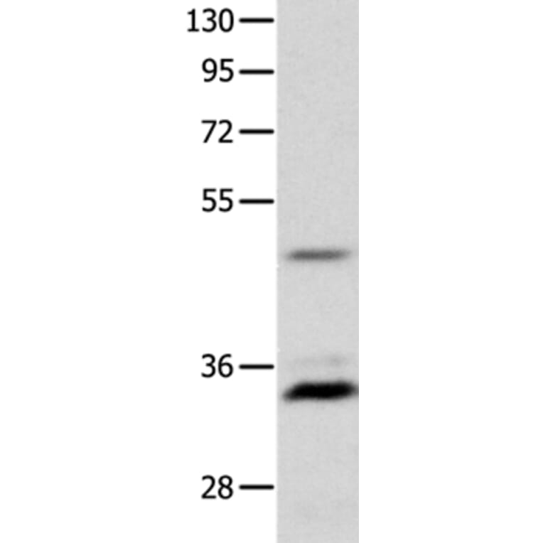 MC1R Antibody from Signalway Antibody (36969) - Antibodies.com
