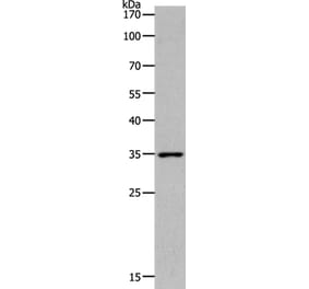 MC2R Antibody from Signalway Antibody (36970) - Antibodies.com