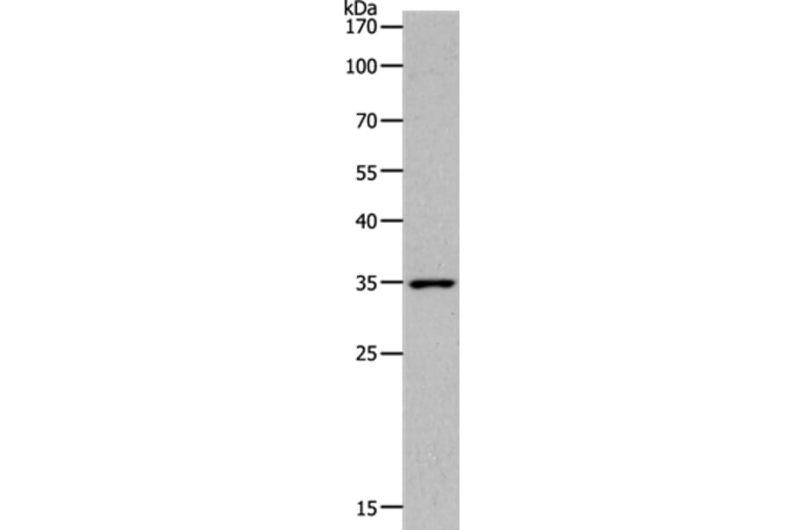 MC2R Antibody from Signalway Antibody (36970) - Antibodies.com