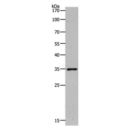 MC2R Antibody from Signalway Antibody (36970) - Antibodies.com