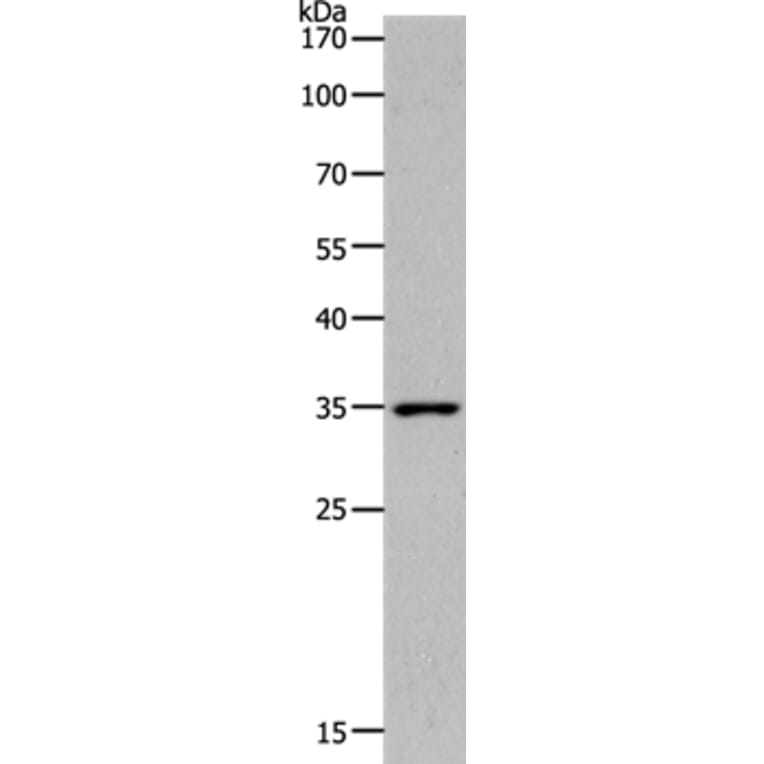 MC2R Antibody from Signalway Antibody (36970) - Antibodies.com