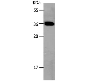 MC3R Antibody from Signalway Antibody (36971) - Antibodies.com