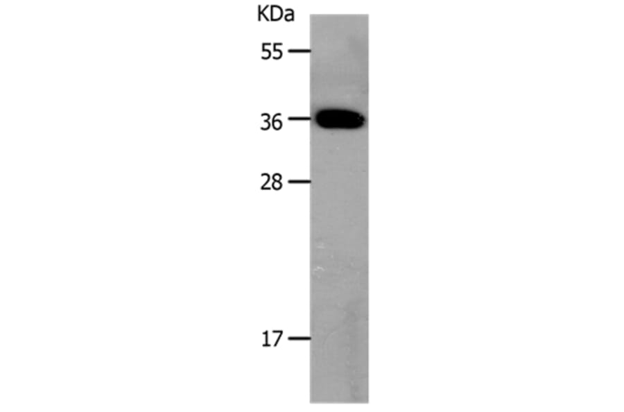MC3R Antibody from Signalway Antibody (36971) - Antibodies.com