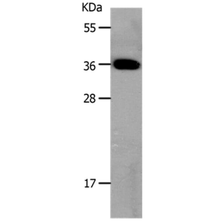 MC3R Antibody from Signalway Antibody (36971) - Antibodies.com