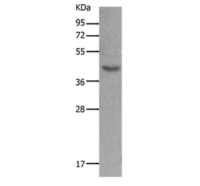 MC5R Antibody from Signalway Antibody (36973) - Antibodies.com