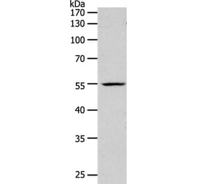PAX1 Antibody from Signalway Antibody (37013) - Antibodies.com