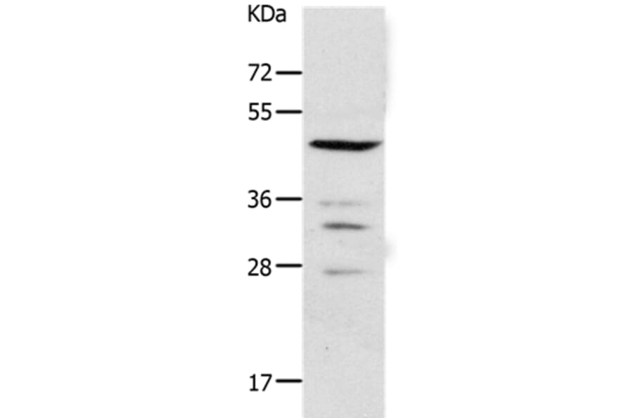PAX2 Antibody from Signalway Antibody (37014) - Antibodies.com