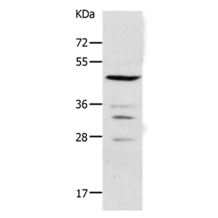 PAX2 Antibody from Signalway Antibody (37014) - Antibodies.com