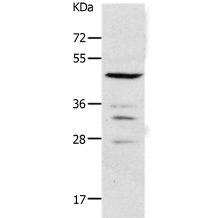 PAX2 Antibody from Signalway Antibody (37014) - Antibodies.com