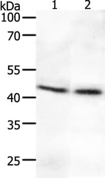 Gel: 10% SDS-PAGE Lysates (from left to right): Human fetal brain and lung tissue Amount of lysate: 50ug per lane Primary antibody: 1/700 dilution Secondary antibody dilution: 1/8000 Exposure time: 40 seconds