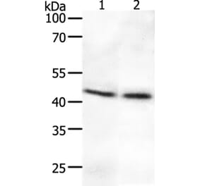 SYT2 Antibody from Signalway Antibody (37044) - Antibodies.com