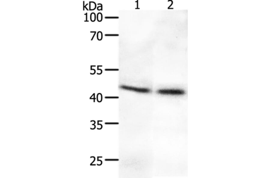 SYT2 Antibody from Signalway Antibody (37044) - Antibodies.com