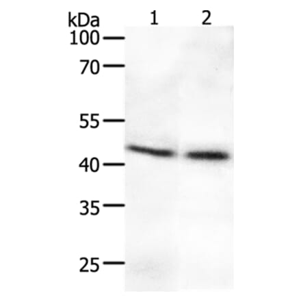 SYT2 Antibody from Signalway Antibody (37044) - Antibodies.com