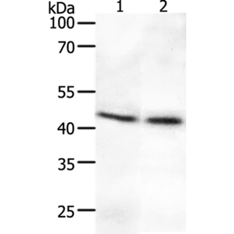 SYT2 Antibody from Signalway Antibody (37044) - Antibodies.com