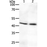 SYT2 Antibody from Signalway Antibody (37044) - Antibodies.com