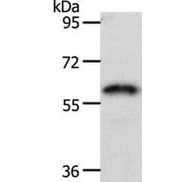 FZD2 Antibody from Signalway Antibody (37068) - Antibodies.com