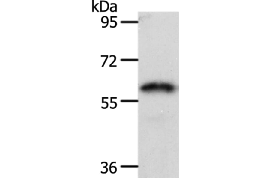 FZD2 Antibody from Signalway Antibody (37068) - Antibodies.com