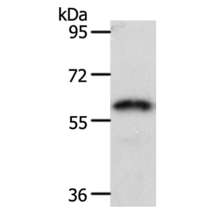 FZD2 Antibody from Signalway Antibody (37068) - Antibodies.com