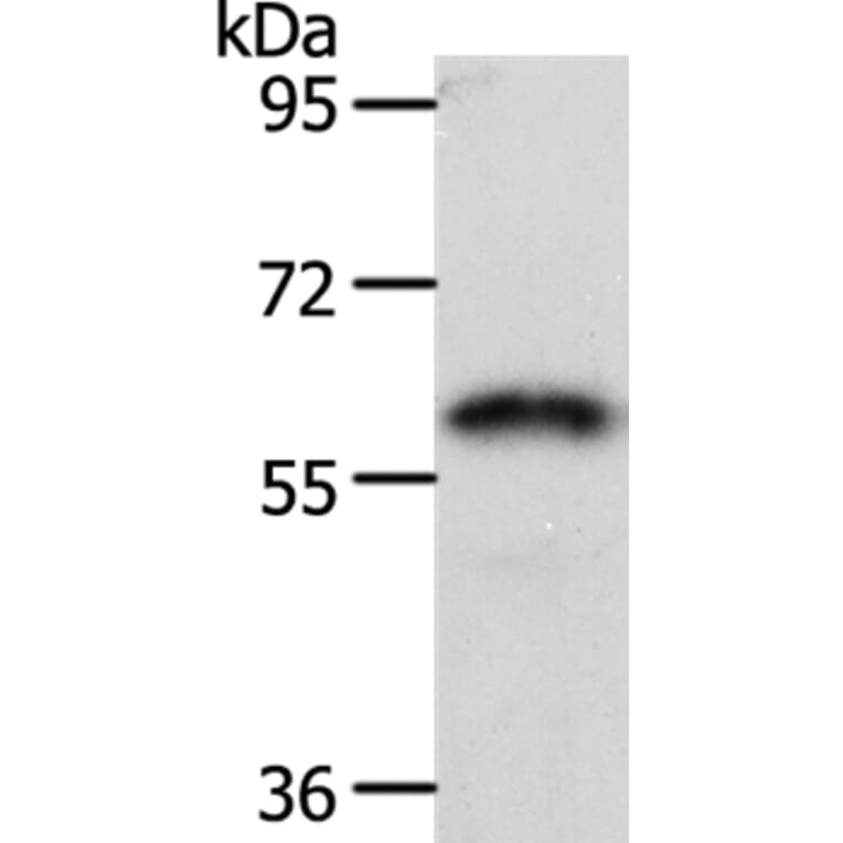 FZD2 Antibody from Signalway Antibody (37068) - Antibodies.com