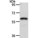 FZD2 Antibody from Signalway Antibody (37068) - Antibodies.com