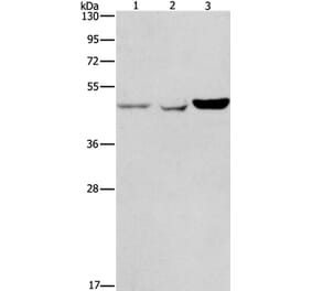 ACP2 Antibody from Signalway Antibody (37080) - Antibodies.com