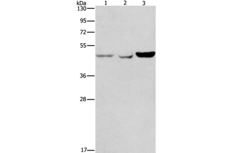 ACP2 Antibody from Signalway Antibody (37080) - Antibodies.com
