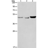 ACP2 Antibody from Signalway Antibody (37080) - Antibodies.com