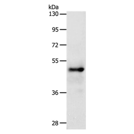 SOX8 Antibody from Signalway Antibody (37248) - Antibodies.com