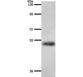 A1BG Antibody from Signalway Antibody (37303) - Antibodies.com
