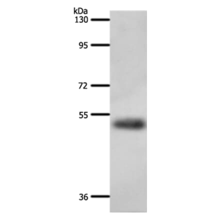 A1BG Antibody from Signalway Antibody (37303) - Antibodies.com