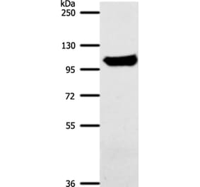 ACO1 Antibody from Signalway Antibody (37306) - Antibodies.com