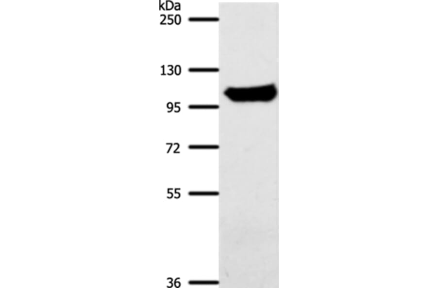 ACO1 Antibody from Signalway Antibody (37306) - Antibodies.com