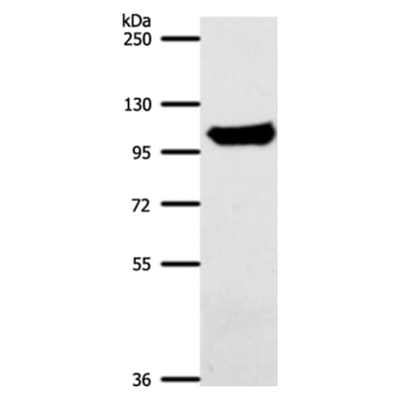 ACO1 Antibody from Signalway Antibody (37306) - Antibodies.com