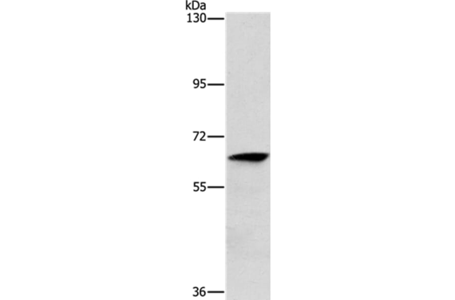 ALG6 Antibody from Signalway Antibody (37326) - Antibodies.com
