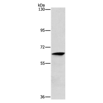 ALG6 Antibody from Signalway Antibody (37326) - Antibodies.com