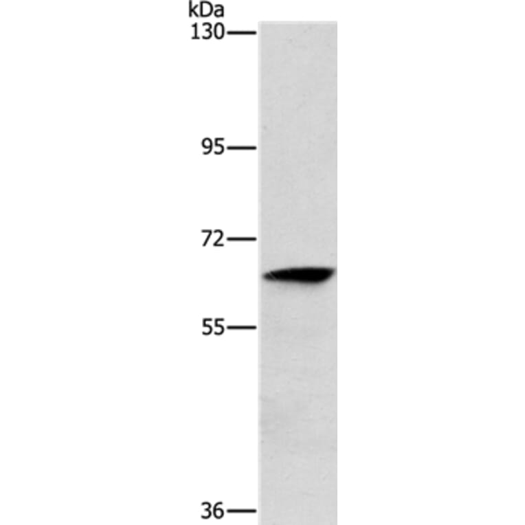 ALG6 Antibody from Signalway Antibody (37326) - Antibodies.com