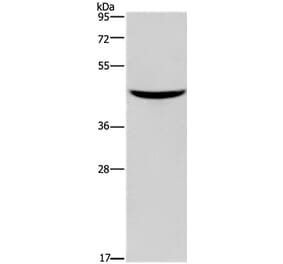 GIPR Antibody from Signalway Antibody (37370) - Antibodies.com