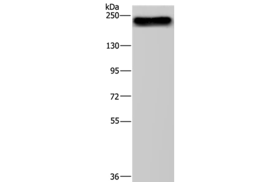 BRD4 Antibody from Signalway Antibody (37393) - Antibodies.com