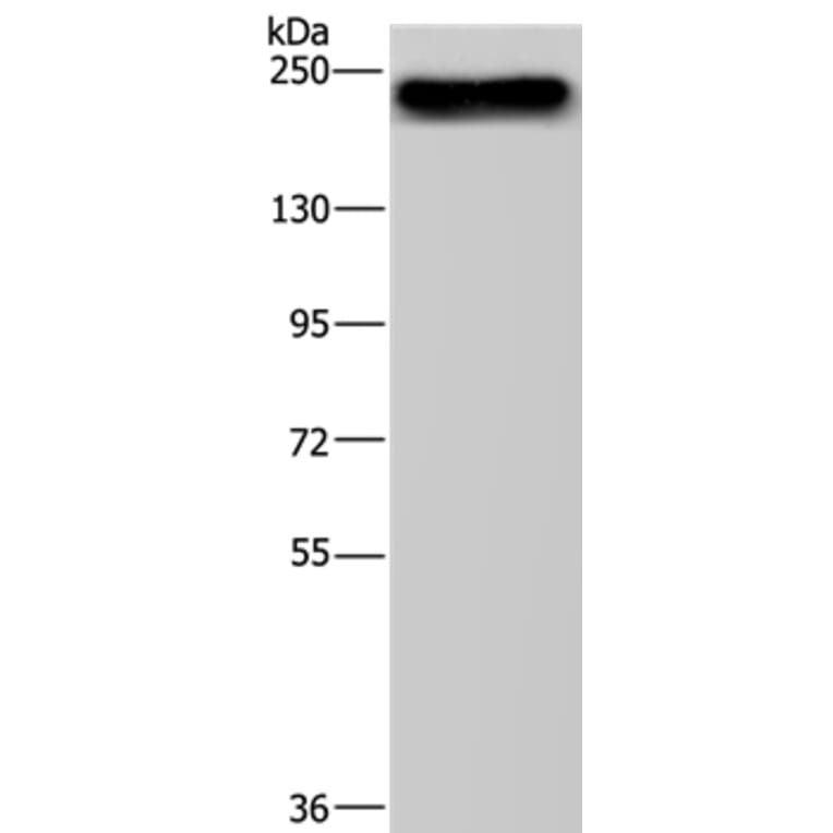 BRD4 Antibody from Signalway Antibody (37393) - Antibodies.com