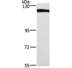DSG1 Antibody from Signalway Antibody (37531) - Antibodies.com
