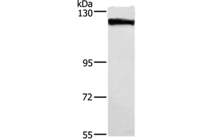 DSG1 Antibody from Signalway Antibody (37531) - Antibodies.com