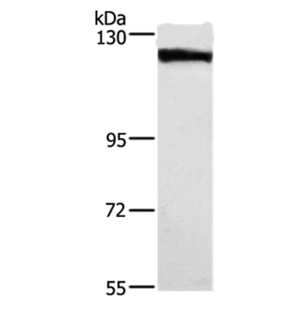 DSG1 Antibody from Signalway Antibody (37531) - Antibodies.com