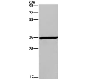 DIO2 Antibody from Signalway Antibody (37535) - Antibodies.com